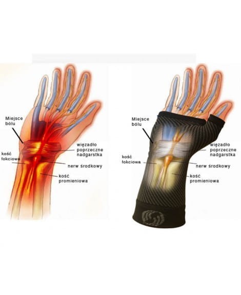 OS1 st dynamiczna opaska stabilizator ściągacz nadgarstka WS6